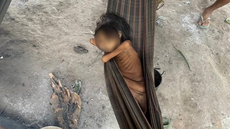 Criança yanomami de 1 ano morre com quadro de desidratação e desnutrição