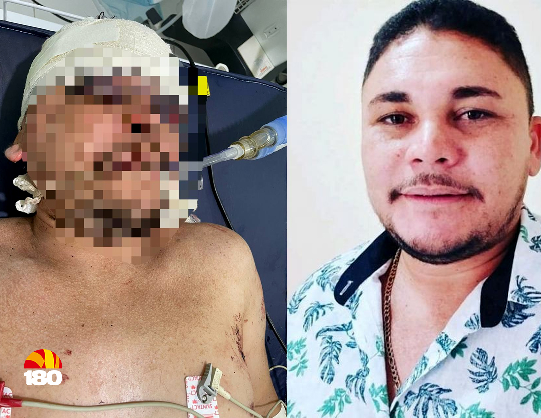 Homem encontrado ferido com dez tiros foi candidato a prefeito em município do Piauí