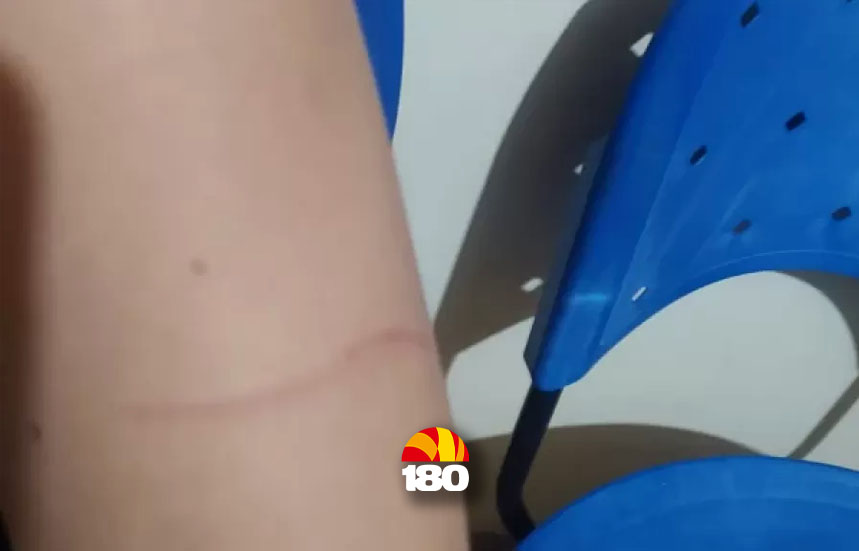 Mulher é atacada pelo ex-companheiro com faca no interior Piauí