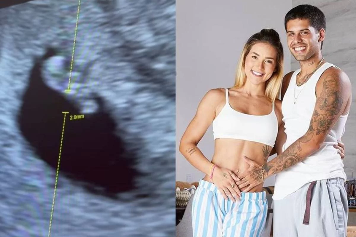 Virginia Fonseca compartilha primeiro ultrassom de seu terceiro bebê