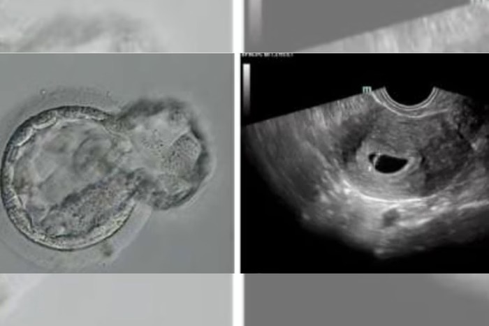 Nasce o primeiro bebê gerado por sistema automatizado de fertilização