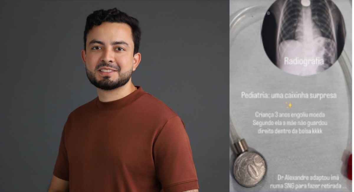 Médico usa criatividade para salvar criança que engoliu moeda de 50 centavos no Piauí