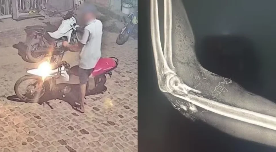 Entregador de pizza é baleado enquanto trabalhava em Barras, no Piauí