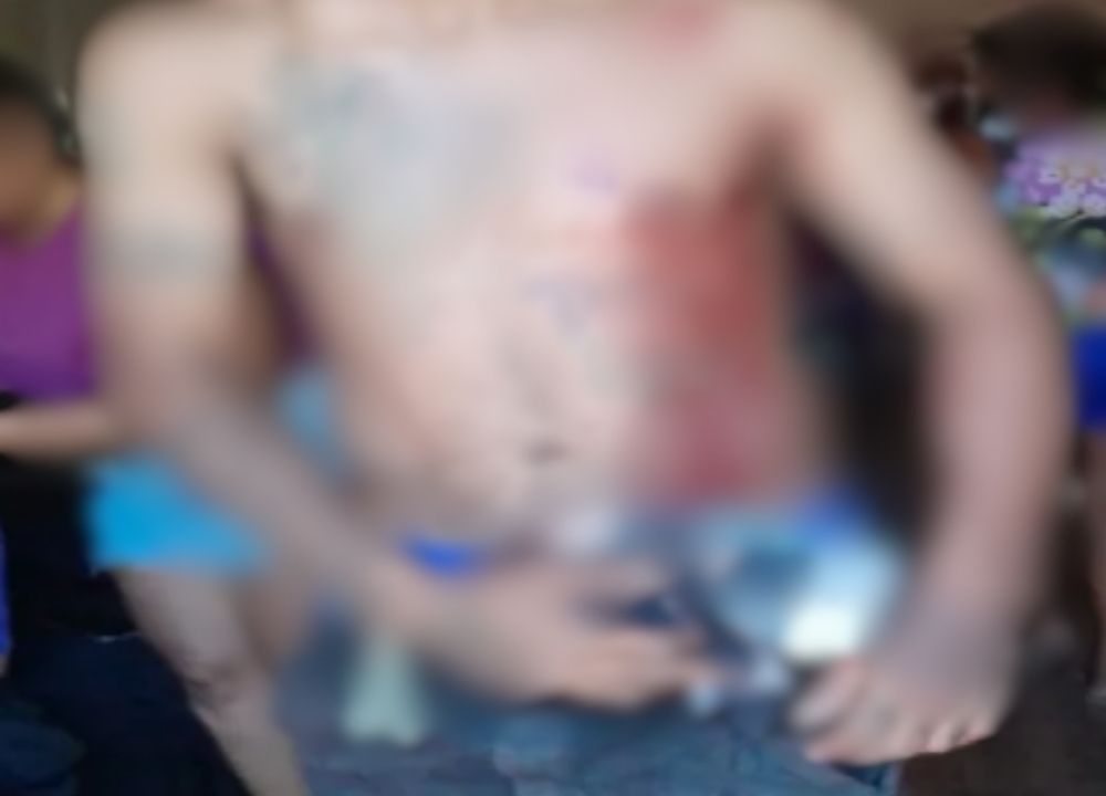 Homem é esfaqueado durante discussão na Rodagem de Floriano, em Oeiras