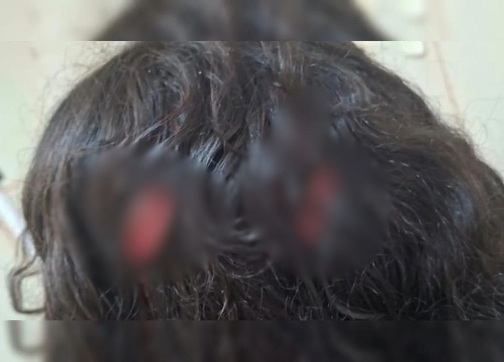 Menina de 12 anos é esfaqueada em sala de aula de escola particular
