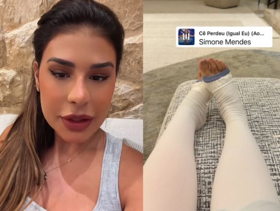 Simone Mendes passa por cirurgia nas coxas e admite