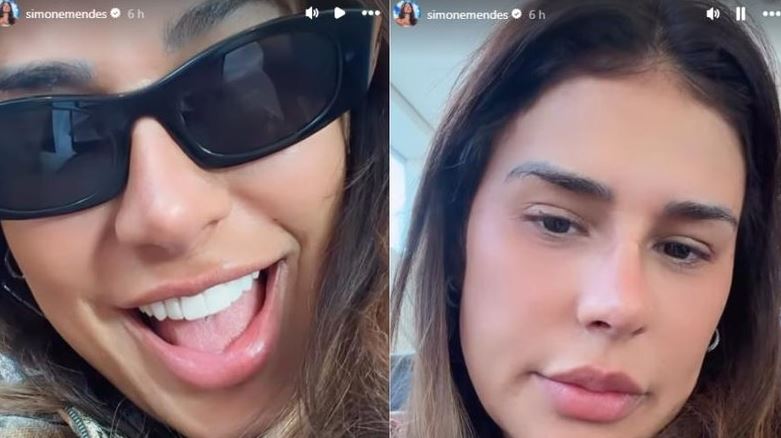 Simone Mendes perde a paciência, rebate críticas ao novo nariz e entrega o que Kaká Diniz achou da mudança