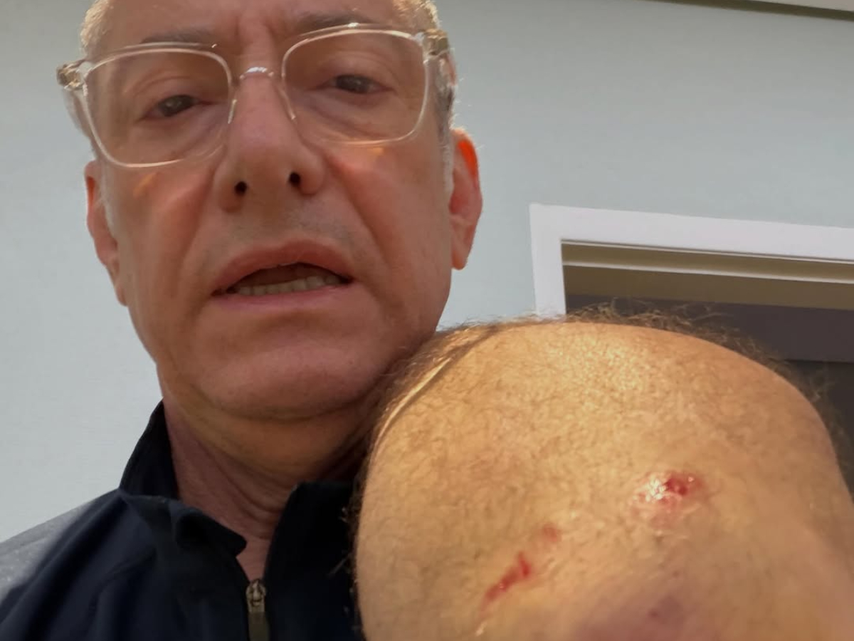 ataque de pitbull em SP