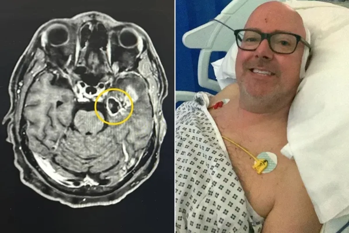Homem confunde tontura com abstinência e descobre tumor cerebral