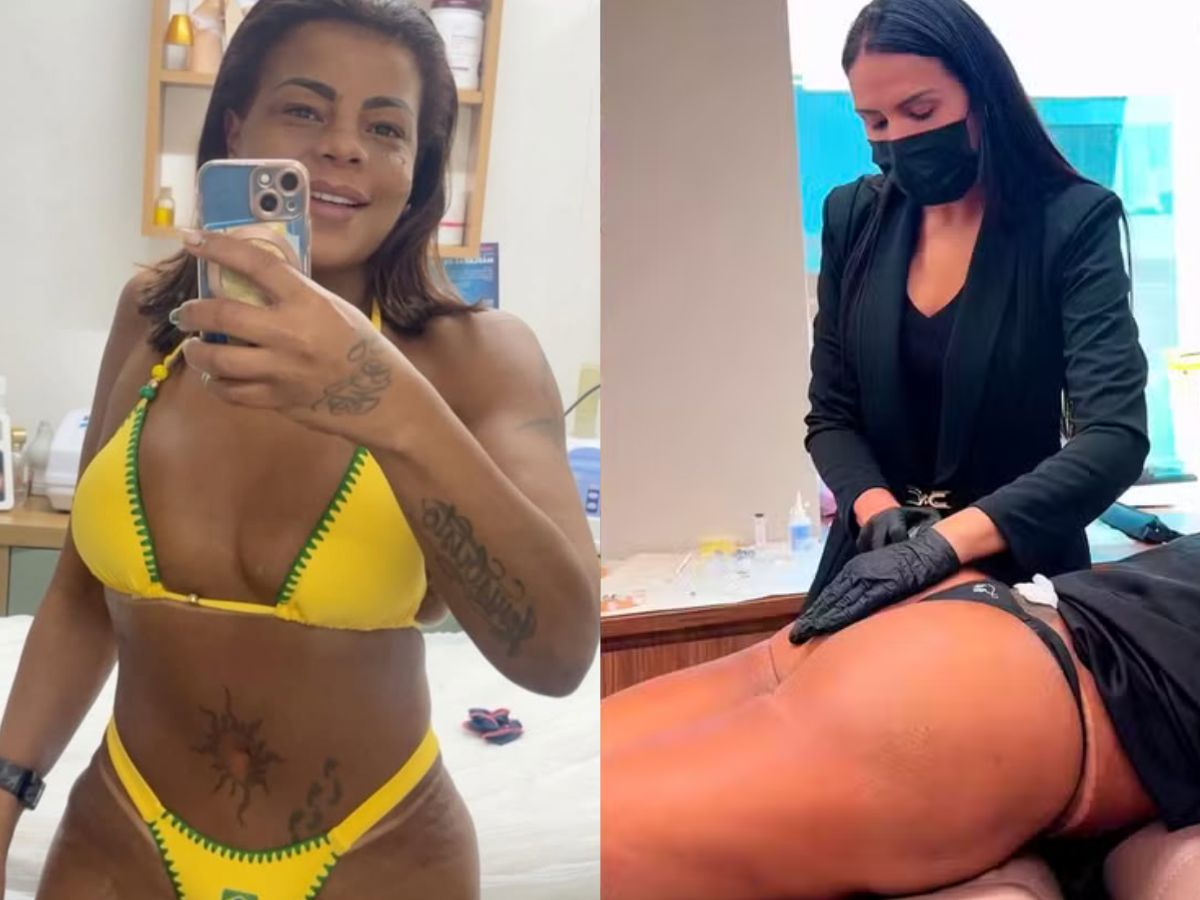 Tati Quebra Barraco faz harmonização no bumbum e brinca