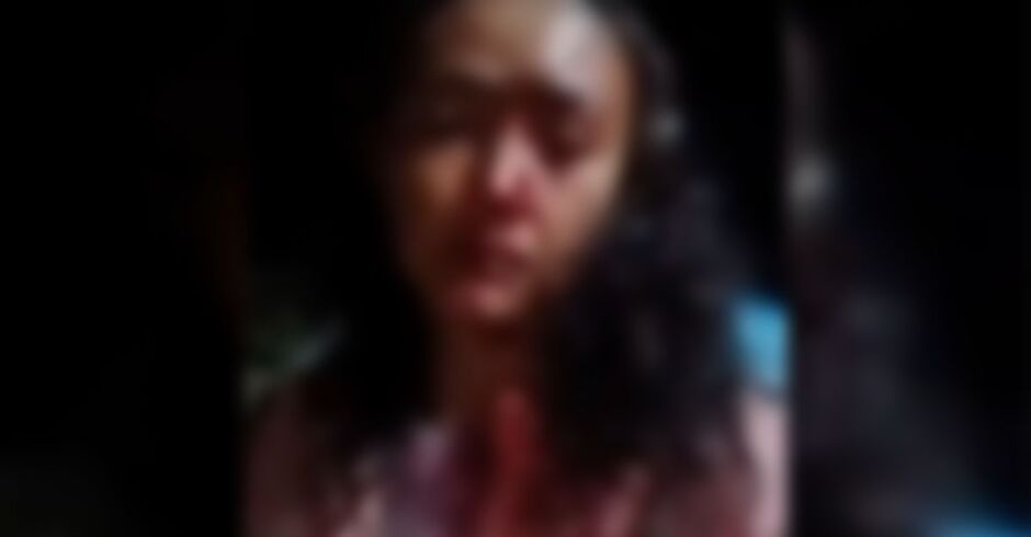Mulher fica com o rosto desfigurado ao ser espancada por pastor em Douradina