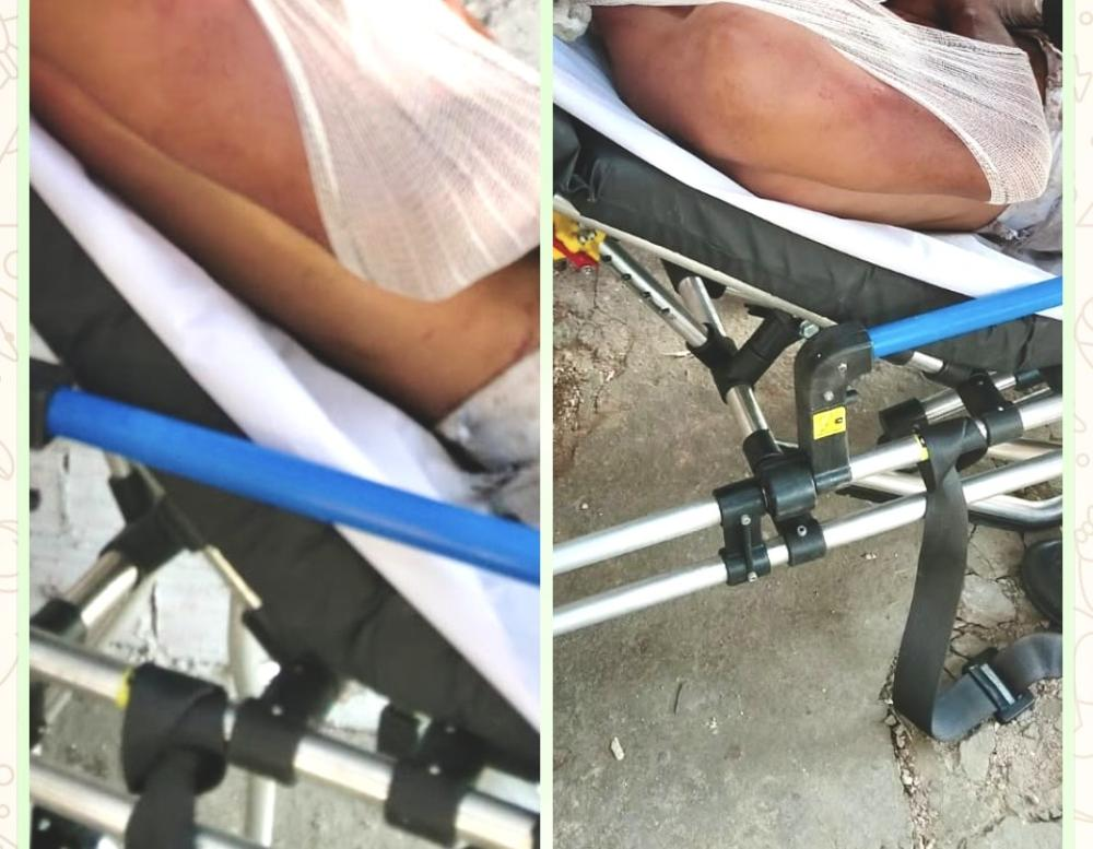 Homem é agredido com pedrada na cabeça após ter casa invadida