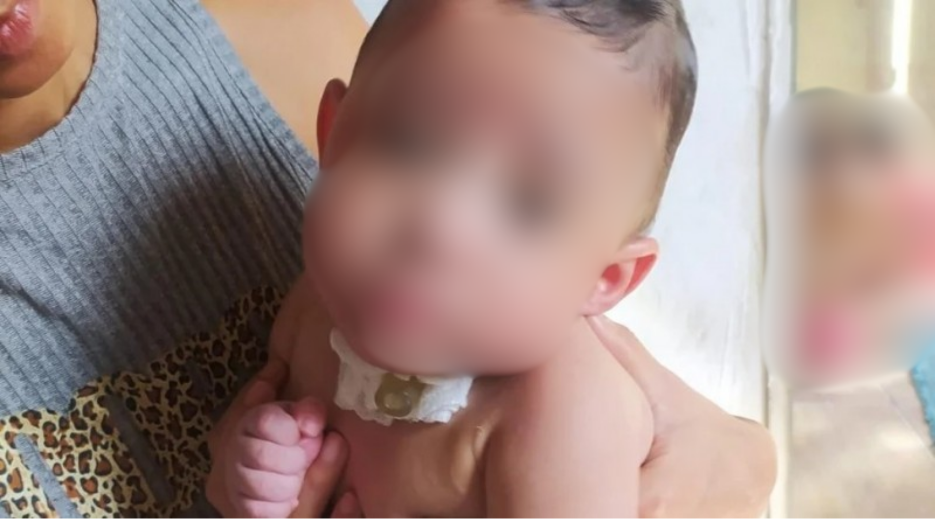 Bebê de 11 meses morre após troca de sonda no HGE; mãe relata perfuração no estômago