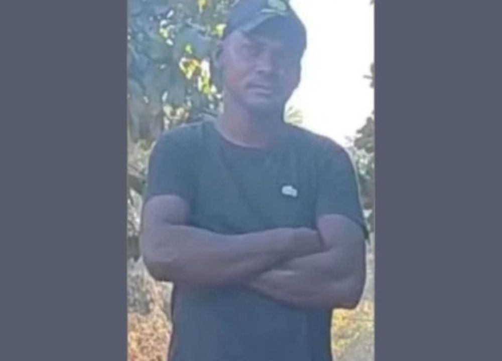 Homem tem 62% do corpo queimado pela companheira e morre após ficar 11 dias internado na Bahia