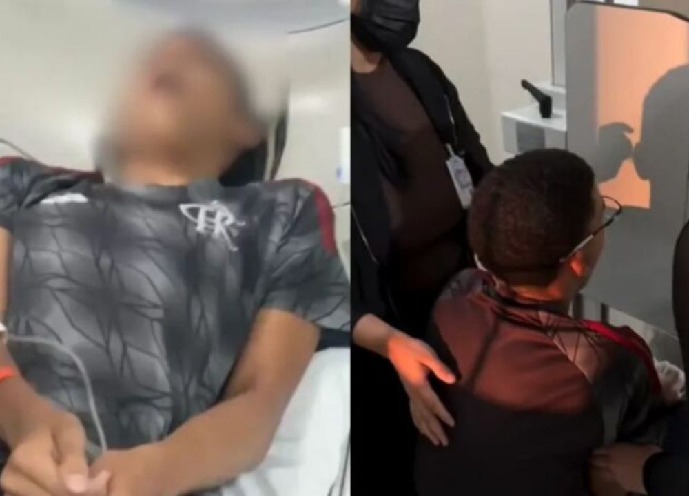 Jovem desloca a mandíbula após bocejar e vai parar na emergência