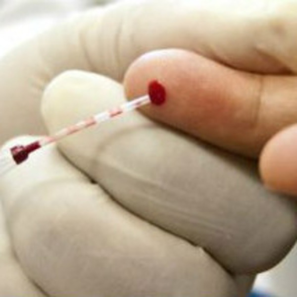 Teste rápido de HIV onde fazer e como funciona