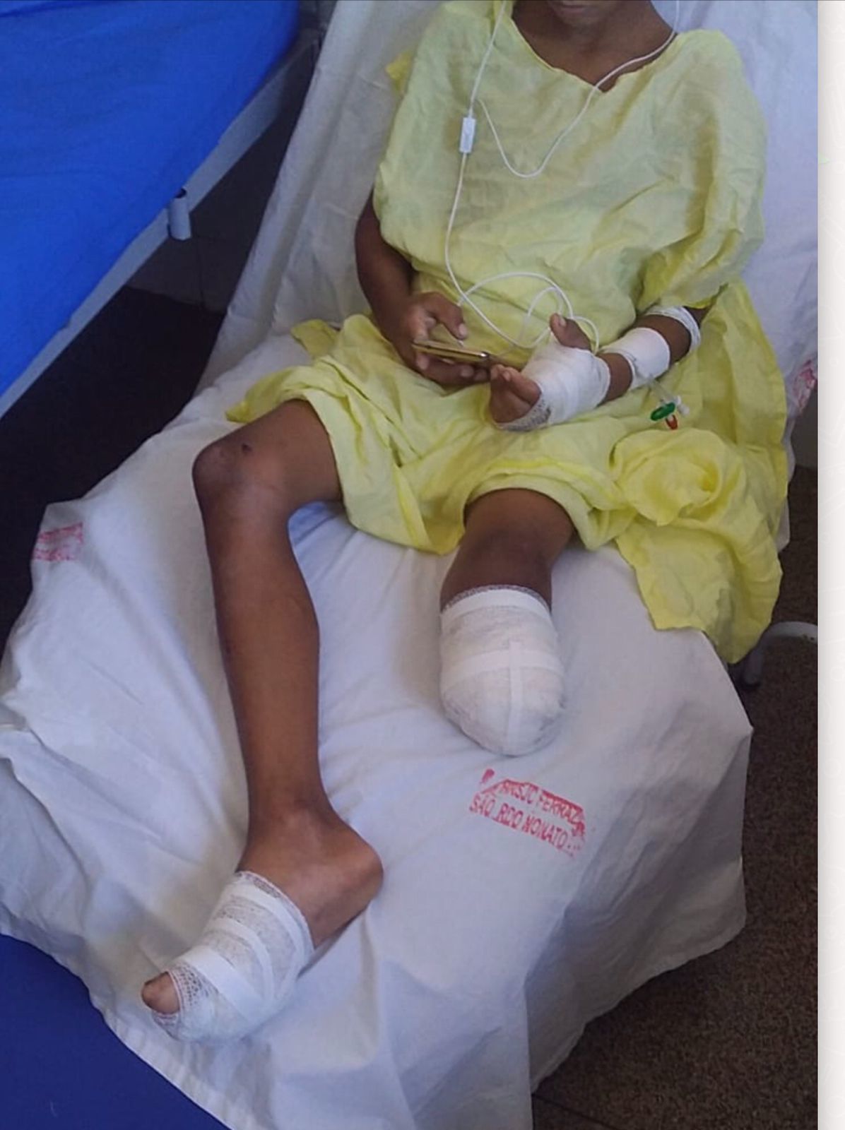 _Criança com perna amputada após cair de ônibus (Foto: Divulgação Familiar)