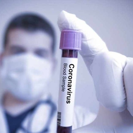 Medium coronavirus covid 19 updates and comparison to sars